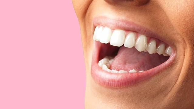Blanchir ses dents soi-même. Des dents plus blanches grâce aux produits de blanchiment