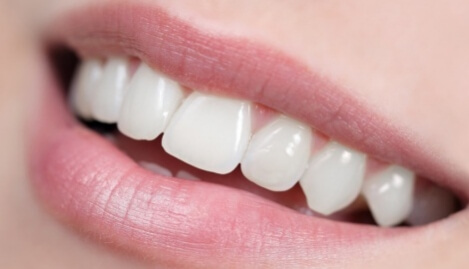 Gezonde tanden zonder tandplak